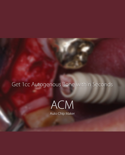 ACM